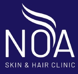 Noa Device mark 5564906 Trademark
