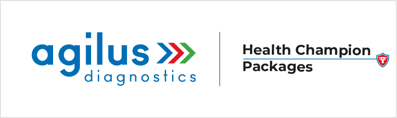 Agilus Diagnostics - Health Champion Packages Device mark 5262911 Trademark