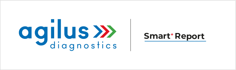 Agilus Diagnostics - Smart + Report Device mark 5270215 Trademark