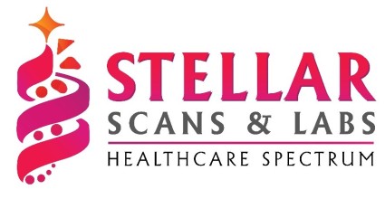 Stellar Scans & Labs - Healthcare Spectrum Device mark 6122183 Trademark