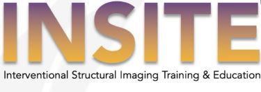 Insite- Interventional Structural Imaging Training And Education Device mark 7378731 Trademark
