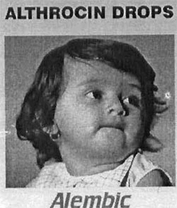 Althrocin Drops ( Device Baby Face ) Device mark 1111899 Trademark