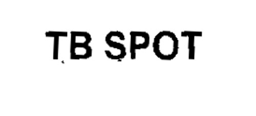 Tb Spot Device mark 1344922 Trademark